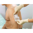 Hartmann Cosmopor E Sterile Absorbent Adhesive Dressing, 20 cm x 10 cm