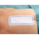 Hartmann Cosmopor E Absorbent Adhesive Dressing, 10 x 6 cm