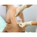 Hartmann Cosmopor E Absorbent Adhesive Dressing, 10 x 6 cm