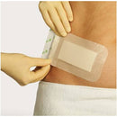 Mepore Adhesive Surgical Dressing
