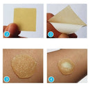 Convatec DuoDERM Extra Thin Dressing Sterile 10 x 10 cm / 4 in x 4 in