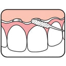 Tepe Bridge And Implant Floss
