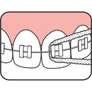 Tepe Bridge And Implant Floss