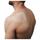 Jelonet Ointment Gauze